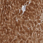 Immunohistochemical staining of human liver shows high expression.