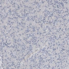 Immunohistochemical staining of human pancreas shows low expression as expected.