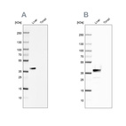 Western blot analysis using Anti-ARG1 antibody HPA024006 (A) shows similar pattern to independent antibody HPA003595 (B).