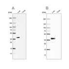 Western blot analysis using Anti-ARG1 antibody HPA024006 (A) shows similar pattern to independent antibody HPA003595 (B).