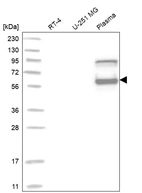 Western blot analysis in human cell line RT-4, human cell line U-251 MG and human plasma.