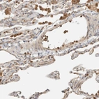 Immunohistochemical staining of human lung shows high expression.