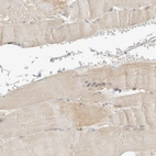 Immunohistochemical staining of human skeletal muscle shows low expression as expected.