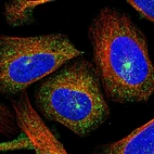 Immunofluorescent staining of human cell line U-2 OS shows localization to cytosol & vesicles.