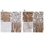 Immunohistochemical staining of human kidney, placenta, skeletal muscle and small intestine using Anti-NAPRT antibody HPA024017 (A) shows similar protein distribution across tissues to independent antibody HPA023739 (B).