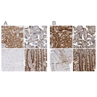 Immunohistochemical staining of human kidney, placenta, skeletal muscle and small intestine using Anti-NAPRT antibody HPA024017 (A) shows similar protein distribution across tissues to independent antibody HPA023739 (B).