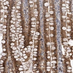 Immunohistochemical staining of human small intestine shows strong cytoplasmic positivity in glandular cells.