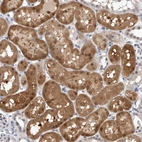 Immunohistochemical staining of human kidney shows strong cytoplasmic positivity in cells in tubules.
