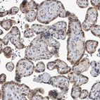 Immunohistochemical staining of human placenta shows moderate cytoplasmic positivity in trophoblastic cells.