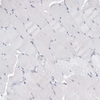 Immunohistochemical staining of human skeletal muscle shows no positivity in myocytes as expected.