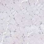 Immunohistochemical staining of human skeletal muscle shows no positivity in myocytes as expected.