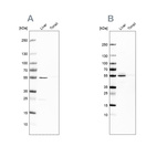 Western blot analysis using Anti-NAPRT antibody HPA024017 (A) shows similar pattern to independent antibody HPA023739 (B).