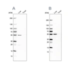 Western blot analysis using Anti-NAPRT antibody HPA024017 (A) shows similar pattern to independent antibody HPA023739 (B).