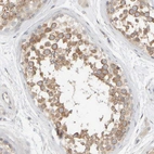 Immunohistochemical staining of human testis shows strong membranous positivity in cells in seminiferous ducts.