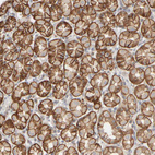 Immunohistochemical staining of human stomach shows strong membranous positivity in glandular cells.