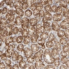 Immunohistochemical staining of human stomach shows strong membranous positivity in glandular cells.