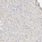 Immunohistochemical staining of human liver shows no membranous positivity in hepatocytes as expected.