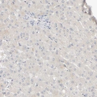 Immunohistochemical staining of human liver shows no membranous positivity in hepatocytes as expected.