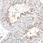 Anti-CEP131 Antibody