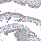Immunohistochemical staining of human fallopian tube shows positivity in cilia in glandular cells.