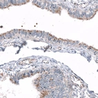 Immunohistochemical staining of human fallopian tube shows positivity in cilia in glandular cells.