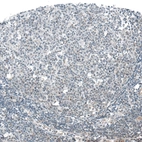 Immunohistochemical staining of human tonsil shows positivity in lymphoid cells.