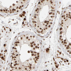 Anti-ZC3HC1 Antibody