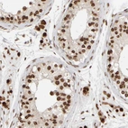Immunohistochemical staining of human testis shows strong positivity in nuclear membrane in cells in seminiferous ducts.