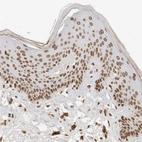 Immunohistochemical staining of human skin shows moderate positivity in nuclear membrane in squamous epithelial cells.