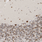 Immunohistochemical staining of human cerebellum shows strong positivity in nuclear membrane in Purkinje cells.