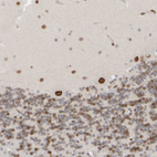 Anti-ZC3HC1 Antibody