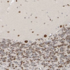 Immunohistochemical staining of human cerebellum shows strong positivity in nuclear membrane in Purkinje cells.