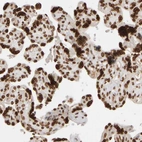 Immunohistochemical staining of human placenta shows strong positivity in nuclear membrane in trophoblastic cells.
