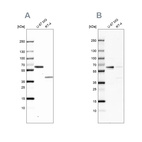 Anti-ZC3HC1 Antibody