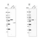 Western blot analysis using Anti-ZC3HC1 antibody HPA024023 (A) shows similar pattern to independent antibody HPA019089 (B).