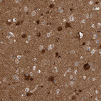 Immunohistochemical staining of human cerebral cortex shows strong granular cytoplasmic positivity in neurons.
