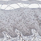 Immunohistochemical staining of human cervix, uterine shows no positivity in squamous epithelial cells as expected.