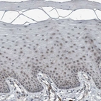 Immunohistochemical staining of human cervix, uterine shows no positivity in squamous epithelial cells as expected.