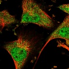 Immunofluorescent staining of human cell line U-251 MG shows localization to nucleoplasm, cytosol & the Golgi apparatus.