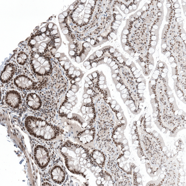 Anti-CAAP1 Antibody
