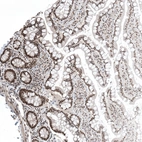 Anti-CAAP1 Antibody