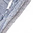 Immunohistochemical staining of human cervix shows strong nuclear positivity in squamous epithelial cells.