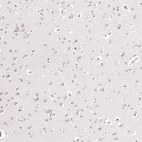 Immunohistochemical staining of human cerebral cortex shows moderate nuclear positivity in neuronal cells.