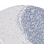 Immunohistochemical staining of human cerebellum shows moderate nuclear positivity in Purkinje cells.