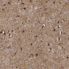 Immunohistochemical staining of human cerebral cortex shows strong cytoplasmic positivity in glial cells.