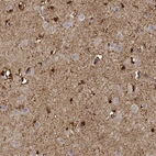Immunohistochemical staining of human cerebral cortex shows strong cytoplasmic positivity in glial cells.