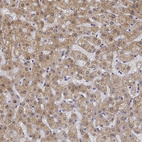 Immunohistochemical staining of human liver shows moderate cytoplasmic positivity in hepatocytes.