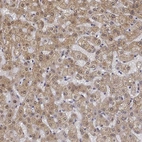 Immunohistochemical staining of human liver shows moderate cytoplasmic positivity in hepatocytes.