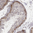 Immunohistochemical staining of human testis shows strong cytoplasmic positivity in cells in seminiferous ducts.