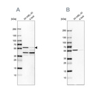 Western blot analysis using Anti-PHGDH antibody HPA024031 (A) shows similar pattern to independent antibody HPA021241 (B).